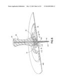 One-Piece Molded Catheter and Method of Manufacture diagram and image