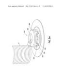 One-Piece Molded Catheter and Method of Manufacture diagram and image