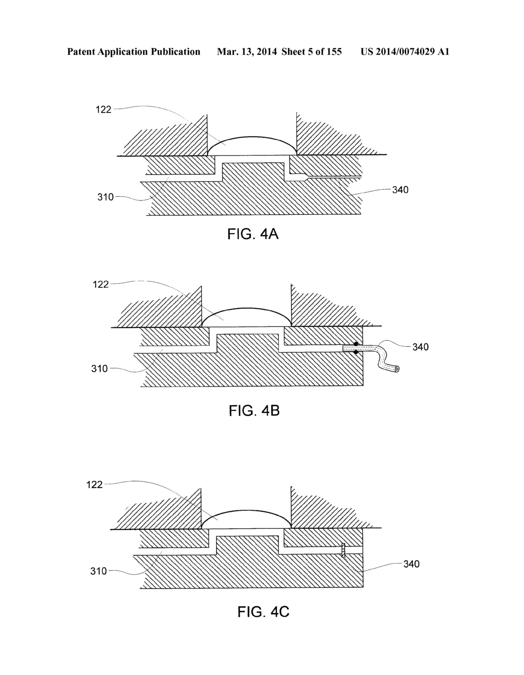 PUMPING FLUID DELIVERY SYSTEMS AND METHODS USING FORCE APPLICATION     ASSEMBLY - diagram, schematic, and image 06