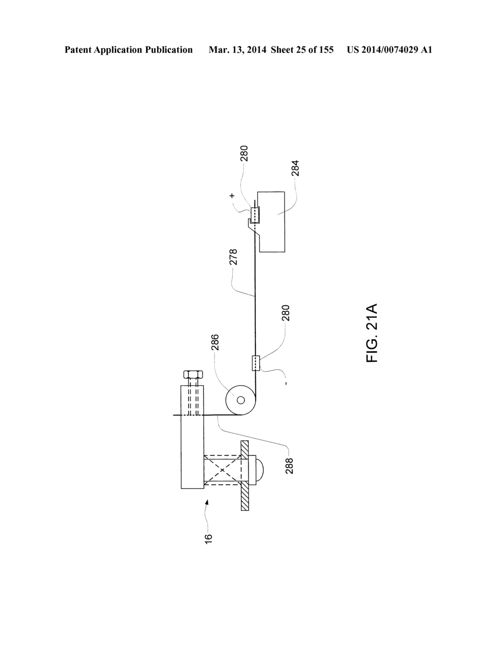 PUMPING FLUID DELIVERY SYSTEMS AND METHODS USING FORCE APPLICATION     ASSEMBLY - diagram, schematic, and image 26