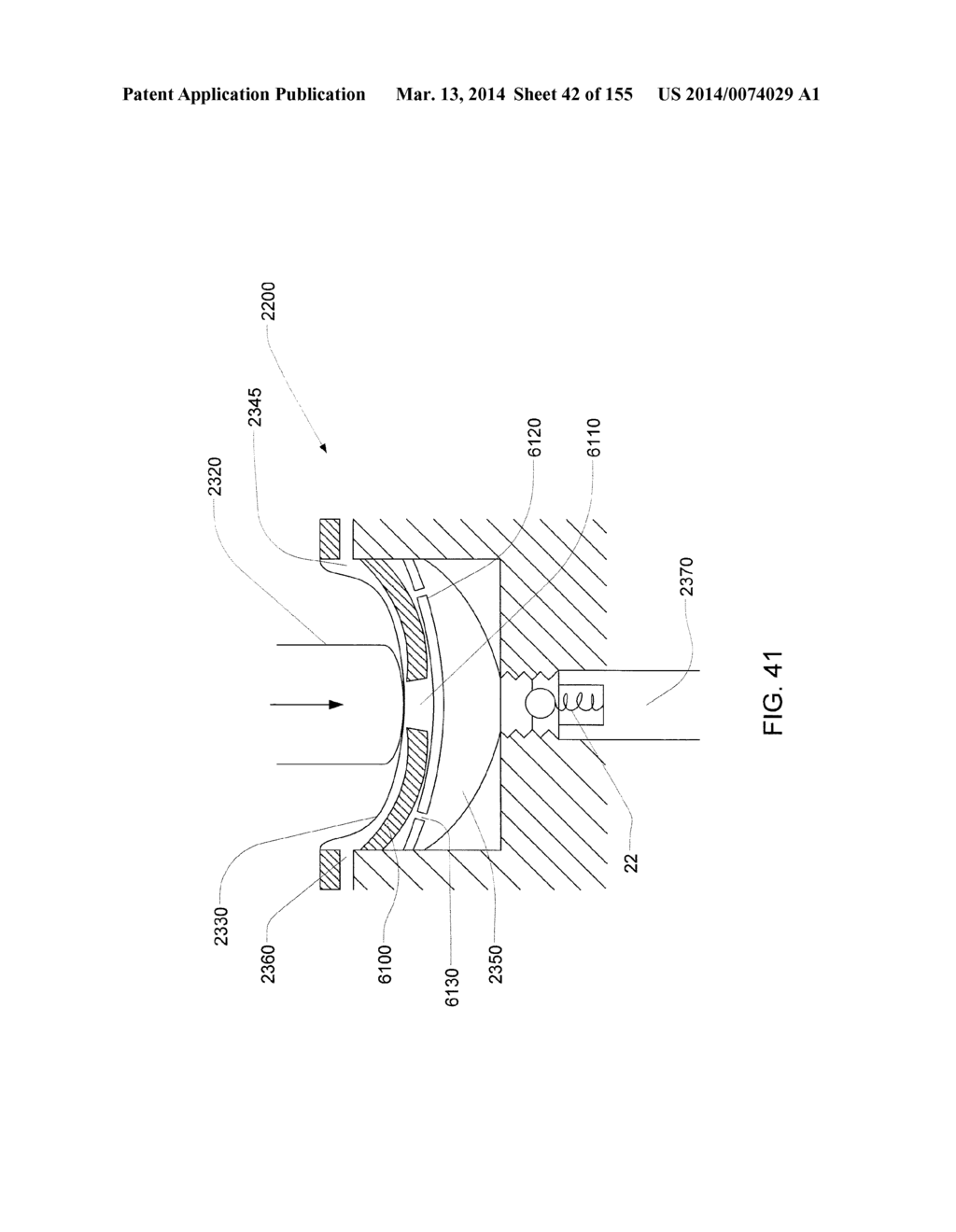 PUMPING FLUID DELIVERY SYSTEMS AND METHODS USING FORCE APPLICATION     ASSEMBLY - diagram, schematic, and image 43