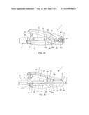 Releasable Blocking System of A Catheter diagram and image