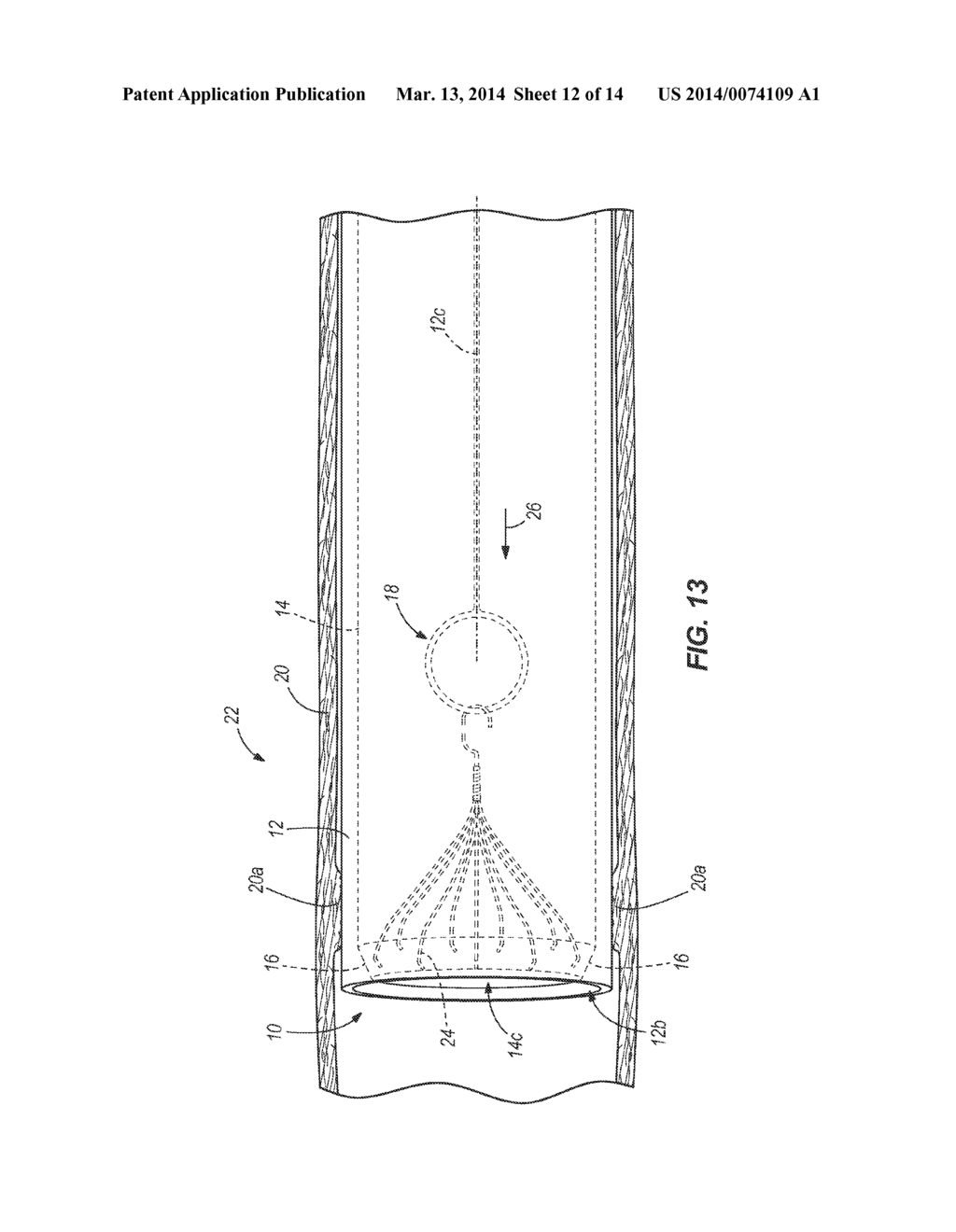 SYSTEM AND METHOD FOR REMOVING AN OBJECT FROM WITHIN A MAMMAL - diagram, schematic, and image 13