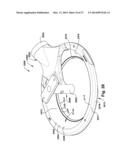 Power Operated Dermatome WIth Shielded Rotary Knife Blade diagram and image