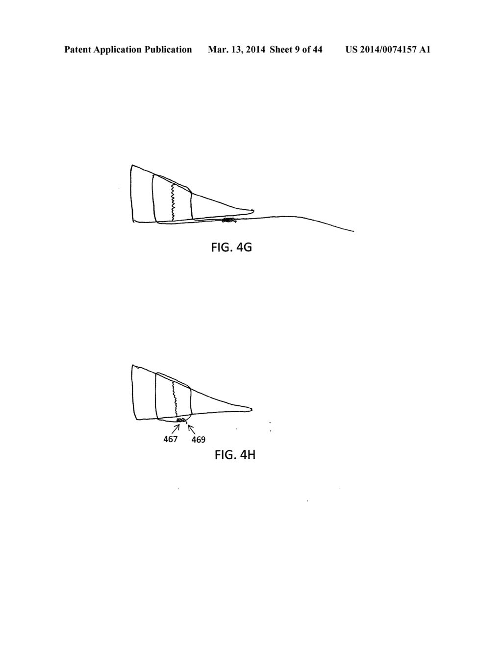 PRE-TIED SURGICAL KNOTS FOR USE WITH SUTURE PASSERS - diagram, schematic, and image 10