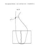 PRE-TIED SURGICAL KNOTS FOR USE WITH SUTURE PASSERS diagram and image