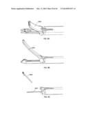 PRE-TIED SURGICAL KNOTS FOR USE WITH SUTURE PASSERS diagram and image