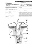 Flexible Planar Member For Tissue Fixation diagram and image