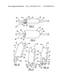 Flexible Planar Member For Tissue Fixation diagram and image