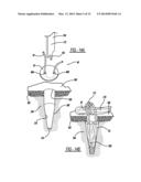 Flexible Planar Member For Tissue Fixation diagram and image