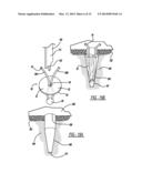 Flexible Planar Member For Tissue Fixation diagram and image