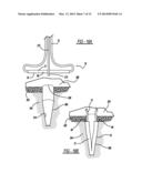 Flexible Planar Member For Tissue Fixation diagram and image