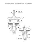 Flexible Planar Member For Tissue Fixation diagram and image