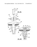 Flexible Planar Member For Tissue Fixation diagram and image