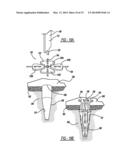 Flexible Planar Member For Tissue Fixation diagram and image