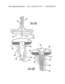 Flexible Planar Member For Tissue Fixation diagram and image