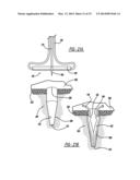 Flexible Planar Member For Tissue Fixation diagram and image