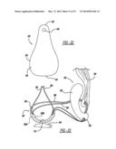 Flexible Planar Member For Tissue Fixation diagram and image