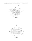 GROWING SPINAL ROD SYSTEM diagram and image