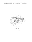 IMPLANT FOR PELVIC RING FRACTURES diagram and image