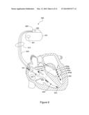 METHOD AND APPARATUS TO PERFORM ELECTRODE COMBINATION SELECTION diagram and image