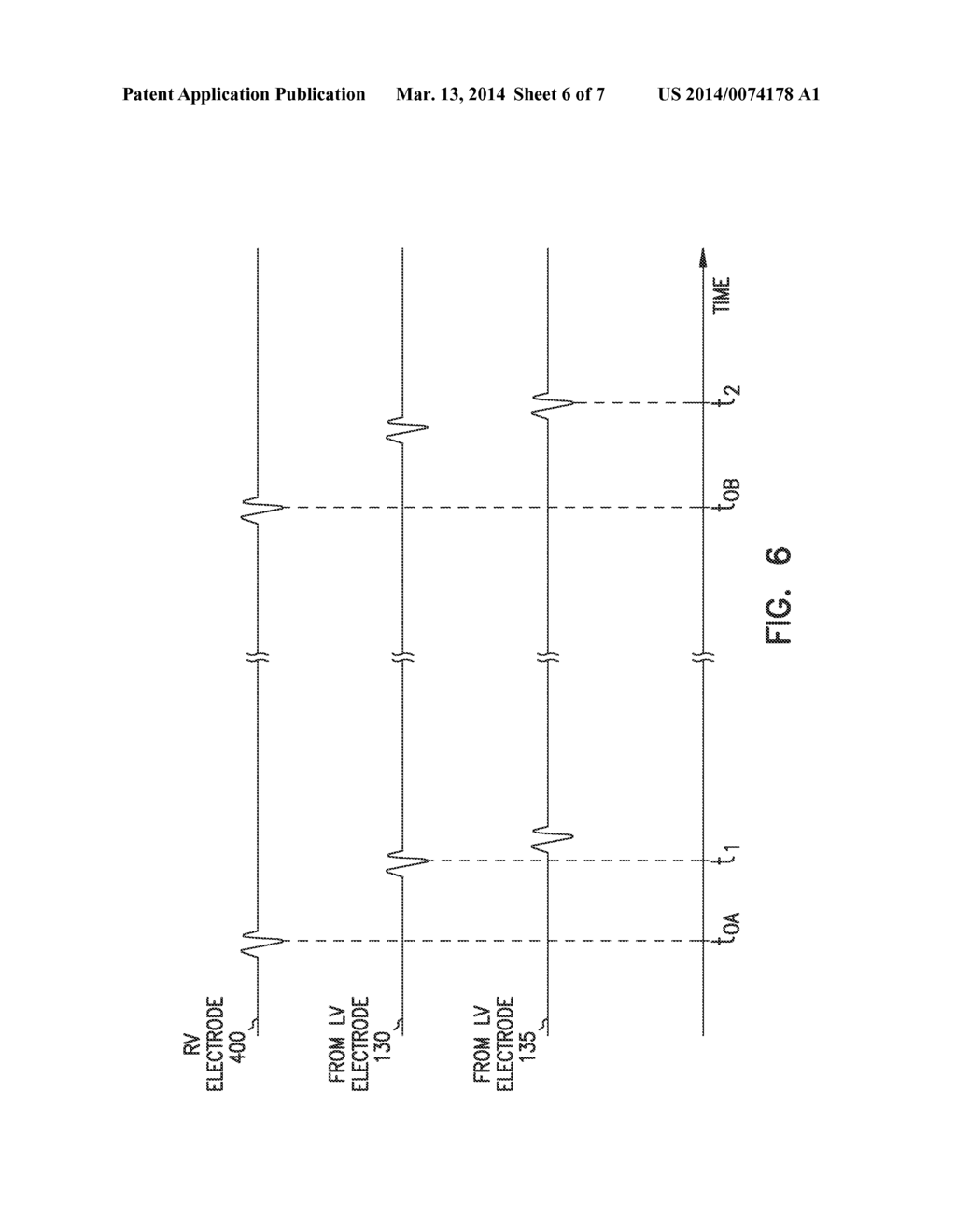 CARDIAC RHYTHM MANAGEMENT SYSTEM SELECTING BETWEEN MULTIPLE SAME-CHAMBER     ELECTRODES FOR DELIVERING CARDIAC THERAPY - diagram, schematic, and image 07