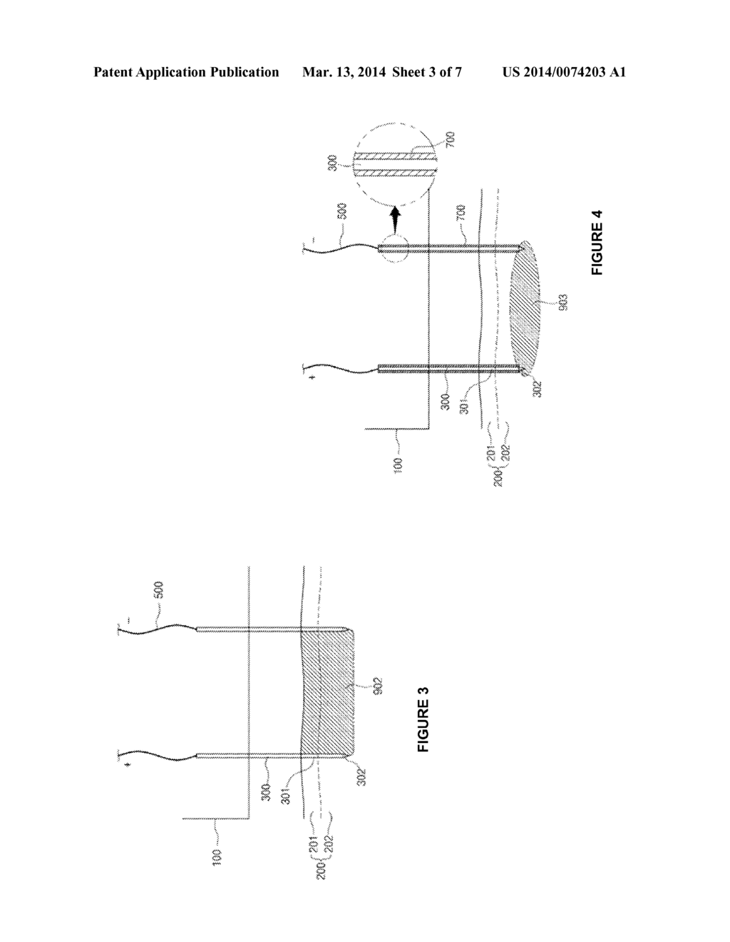 ELECTRICALLY BASED MEDICAL TREATMENT DEVICE AND METHOD - diagram, schematic, and image 04