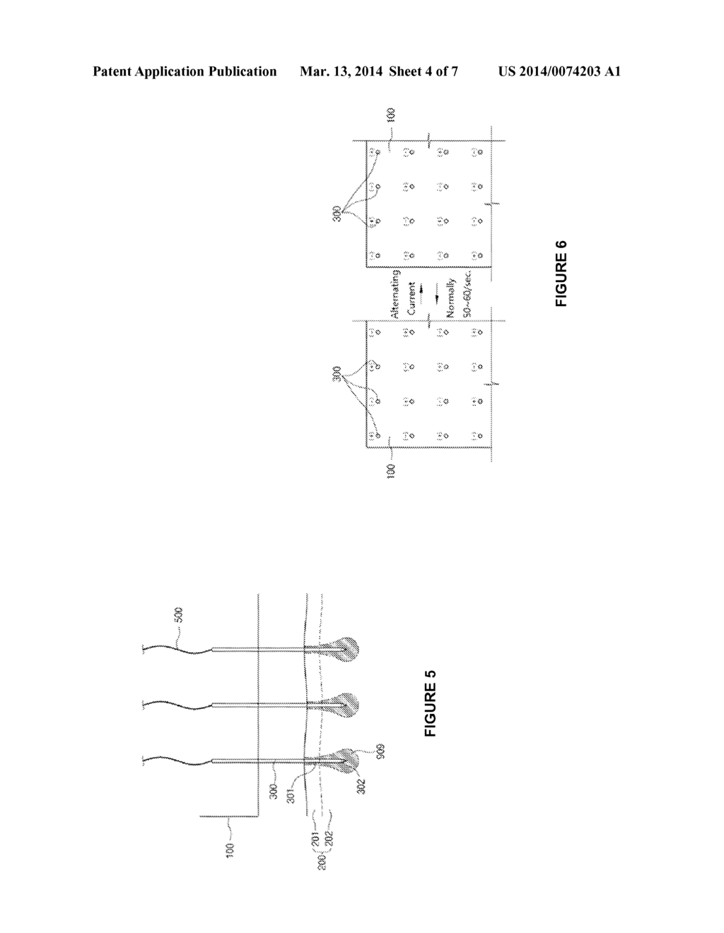 ELECTRICALLY BASED MEDICAL TREATMENT DEVICE AND METHOD - diagram, schematic, and image 05