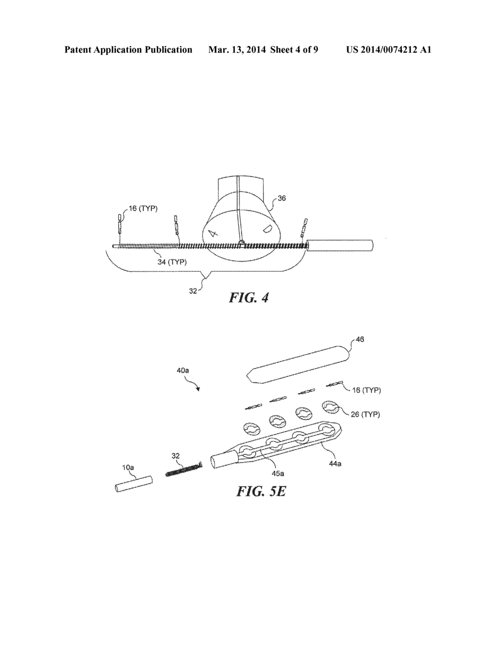 MEDICAL LEAD TERMINATION SLEEVE FOR IMPLANTABLE MEDICAL DEVICES - diagram, schematic, and image 05