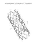 ADHESIVE STENT COATING FOR ANTI-MIGRATION diagram and image