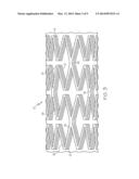 ADHESIVE STENT COATING FOR ANTI-MIGRATION diagram and image