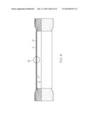 ADHESIVE STENT COATING FOR ANTI-MIGRATION diagram and image