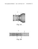 Transcatheter Prosthetic Heart Valve Delivery Device with Stability Tube     and Method diagram and image