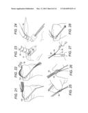 ADJUSTABLE SUTURE-BUTTON CONSTRUCTS FOR LIGAMENT RECONSTRUCTION diagram and image