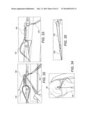 ADJUSTABLE SUTURE-BUTTON CONSTRUCTS FOR LIGAMENT RECONSTRUCTION diagram and image