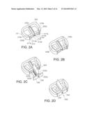 Fixation Devices for Anterior Lumbar or Cervical Interbody Fusion diagram and image