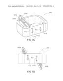 Fixation Devices for Anterior Lumbar or Cervical Interbody Fusion diagram and image