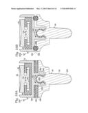 RADIAL HEAD PROSTHESIS WITH FLOATING ARTICULAR MEMBER diagram and image