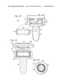 RADIAL HEAD PROSTHESIS WITH FLOATING ARTICULAR MEMBER diagram and image