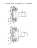 RADIAL HEAD PROSTHESIS WITH FLOATING ARTICULAR MEMBER diagram and image