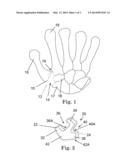 JOINT RECONSTRUCTION SYSTEM AND METHOD diagram and image