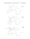 Instrument for Engaging an Engaging Means on an Implant diagram and image