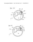 ARTIFICIAL ANKLE, ARTIFICIAL FOOT AND ARTIFICIAL LEG diagram and image