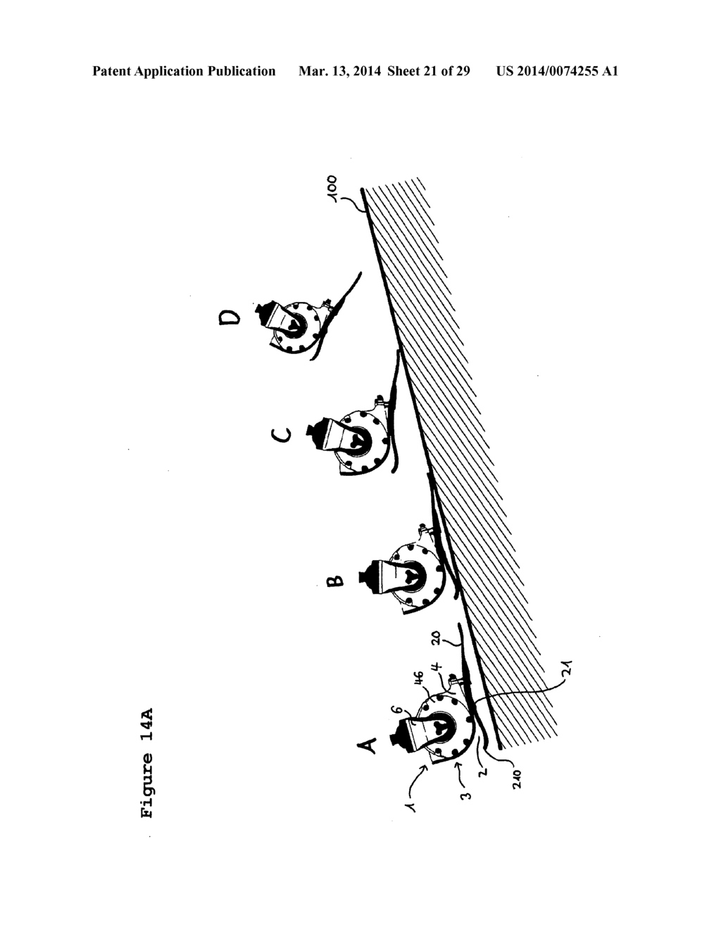 ARTIFICIAL ANKLE, ARTIFICIAL FOOT AND ARTIFICIAL LEG - diagram, schematic, and image 22