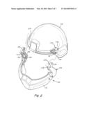 MANDIBLE GUARD ATTACHMENT SYSTEM diagram and image