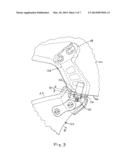 MANDIBLE GUARD ATTACHMENT SYSTEM diagram and image