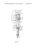 MANDIBLE GUARD ATTACHMENT SYSTEM diagram and image