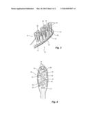 BRISTLE CONFIGURATION diagram and image