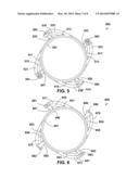 ROTATABLE RING BIVALVE HOUSING diagram and image