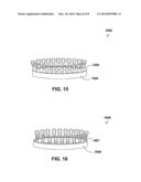 ROTATABLE RING BIVALVE HOUSING diagram and image